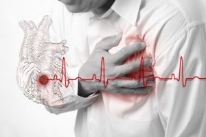 Все об инфаркте миокарда: причины, симптомы, диагностика и первая помощь