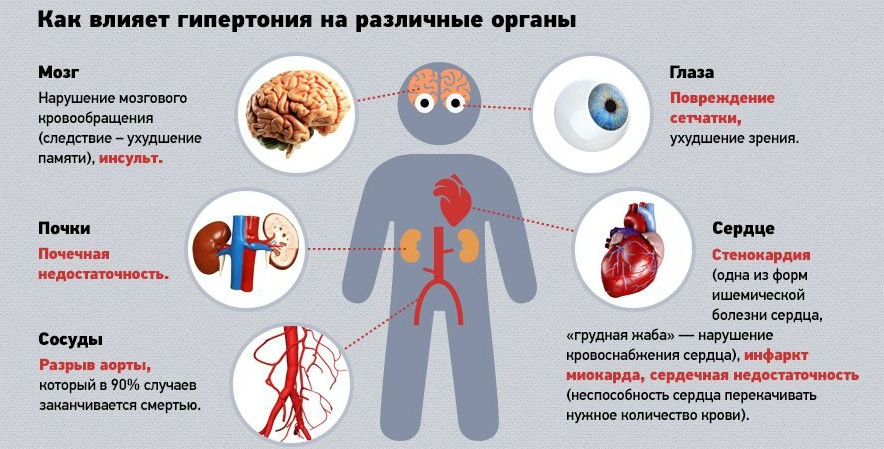 Методы лечения гипертонии: медикаментозные и немедикаментозные способы борьбы с заболеванием