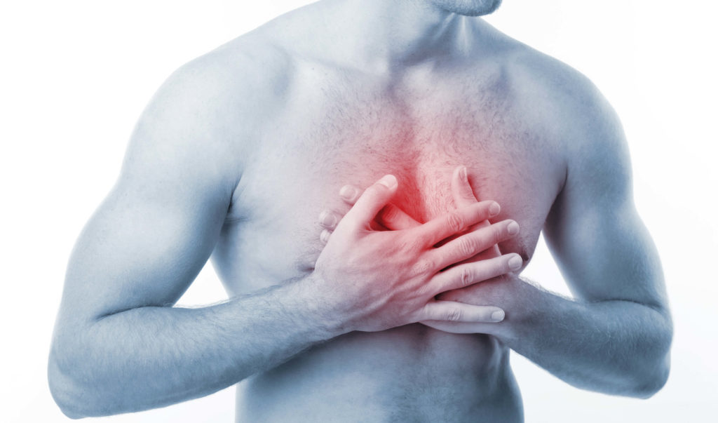 Эмболия легочной артерии: причины, симптомы, диагностика и лечение